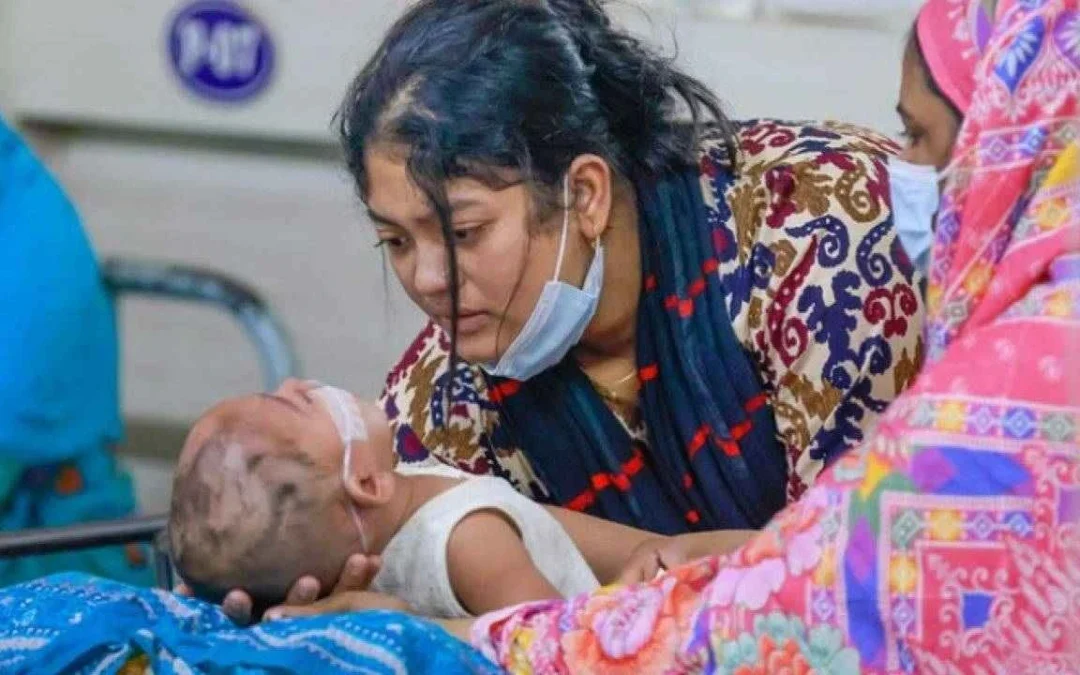 হাম ও উপসর্গে ৪ শিশুর মৃত্যু: নতুন আক্রান্ত ৯১৭ জন